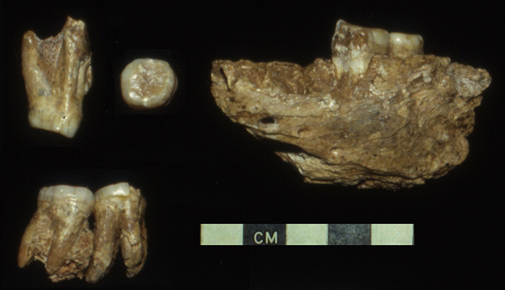 Hexian PA831 mandible